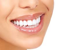 teeth whitening